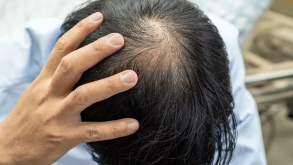 shampo untuk mengatasi rambut rontok dari akar